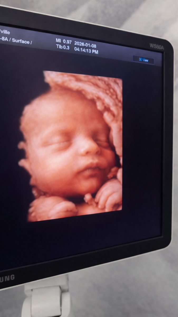 A 3D sonogram displayed on a TOTville scanner monitor.