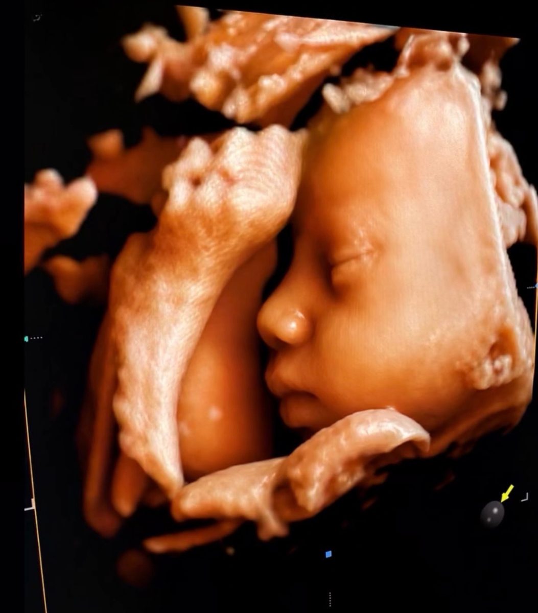 3D sonogram of a sleeping baby in profile.