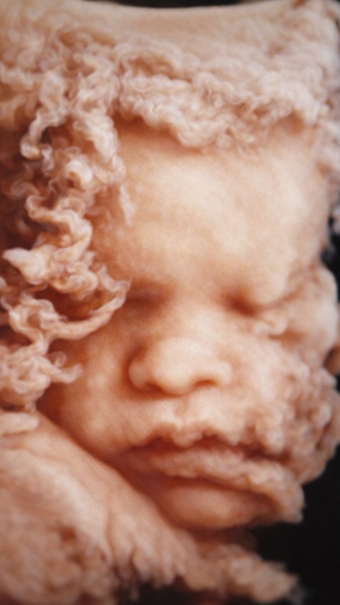 3D sonogram of a baby.