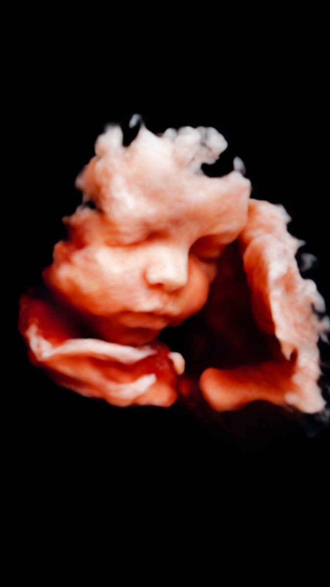 3D sonogram of a baby.