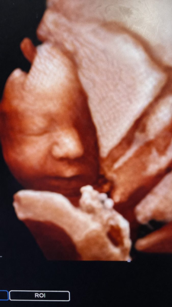 3D sonogram of a sleeping baby.