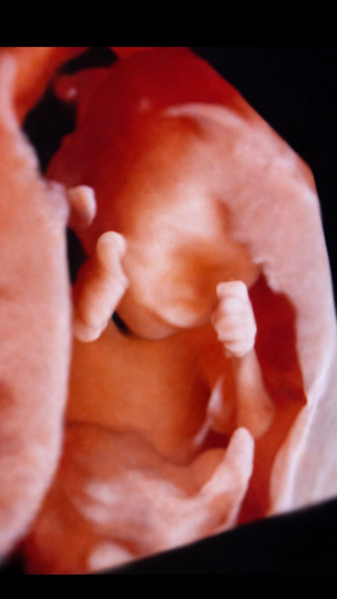 3D sonogram of a baby.