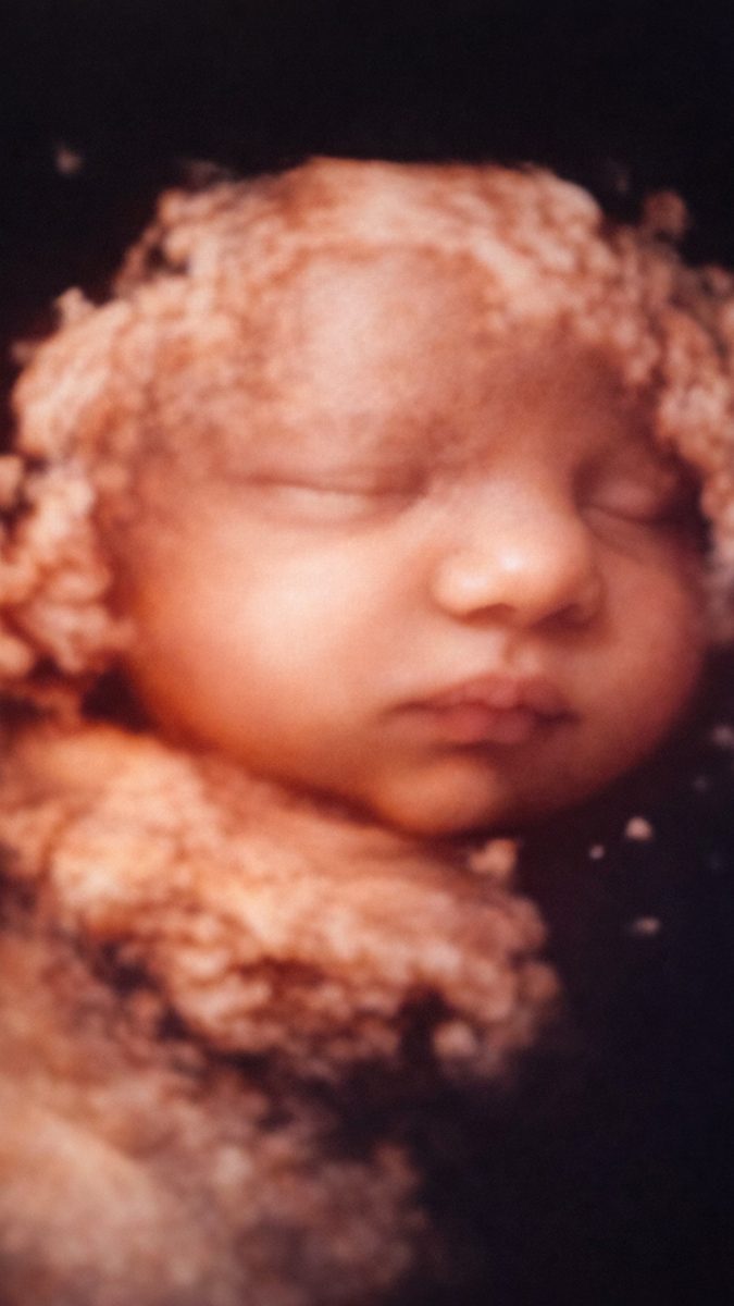 3D sonogram of a sleeping baby.